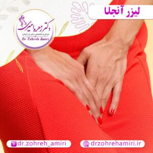 مقالات 4 لیزر آنجلا و خدمات آن