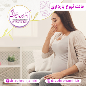 حالت تهوع بارداری