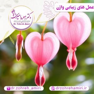 مقالات 5 انواع عمل های زیبایی واژن