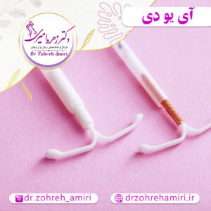 مقالات 12 آی یو دی و قرار دادن آن در رحم