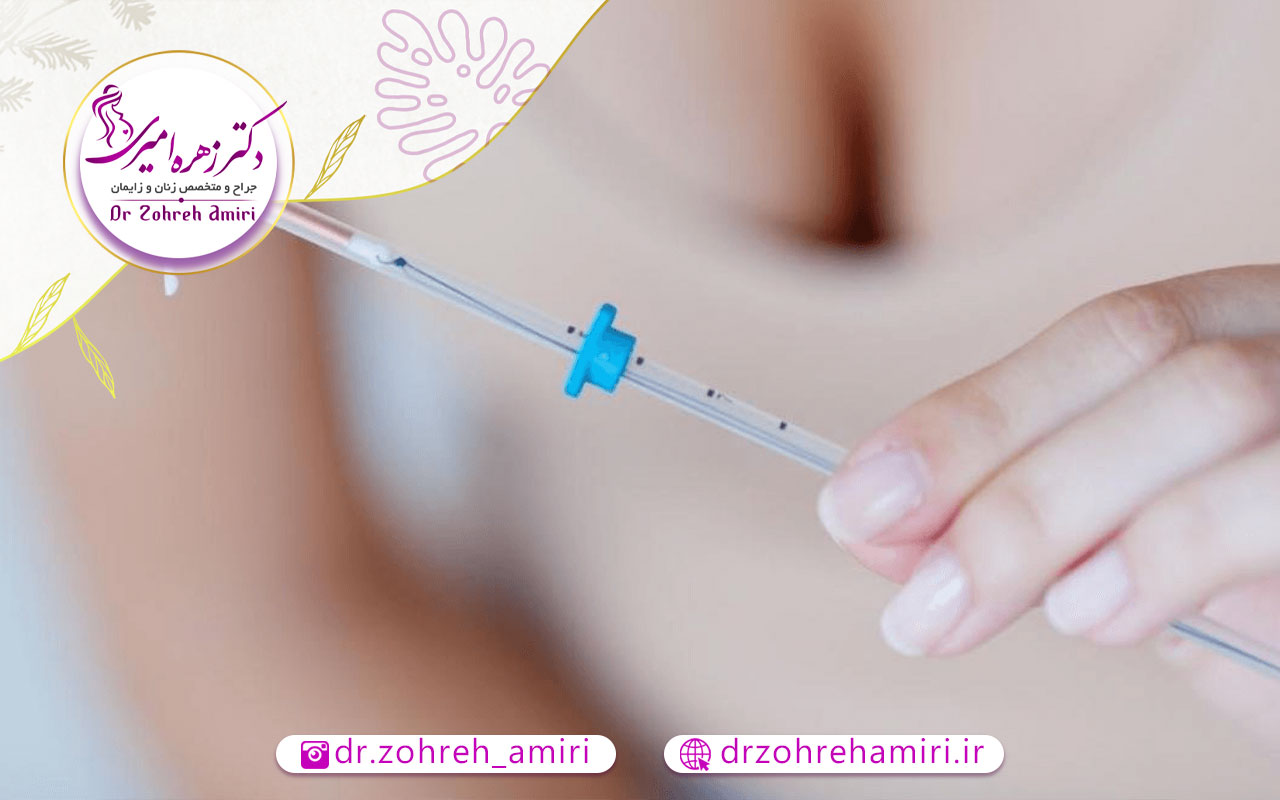 آی یو دی و قرار دادن آن در رحم 1 عوارض احتمالی آی یو دی