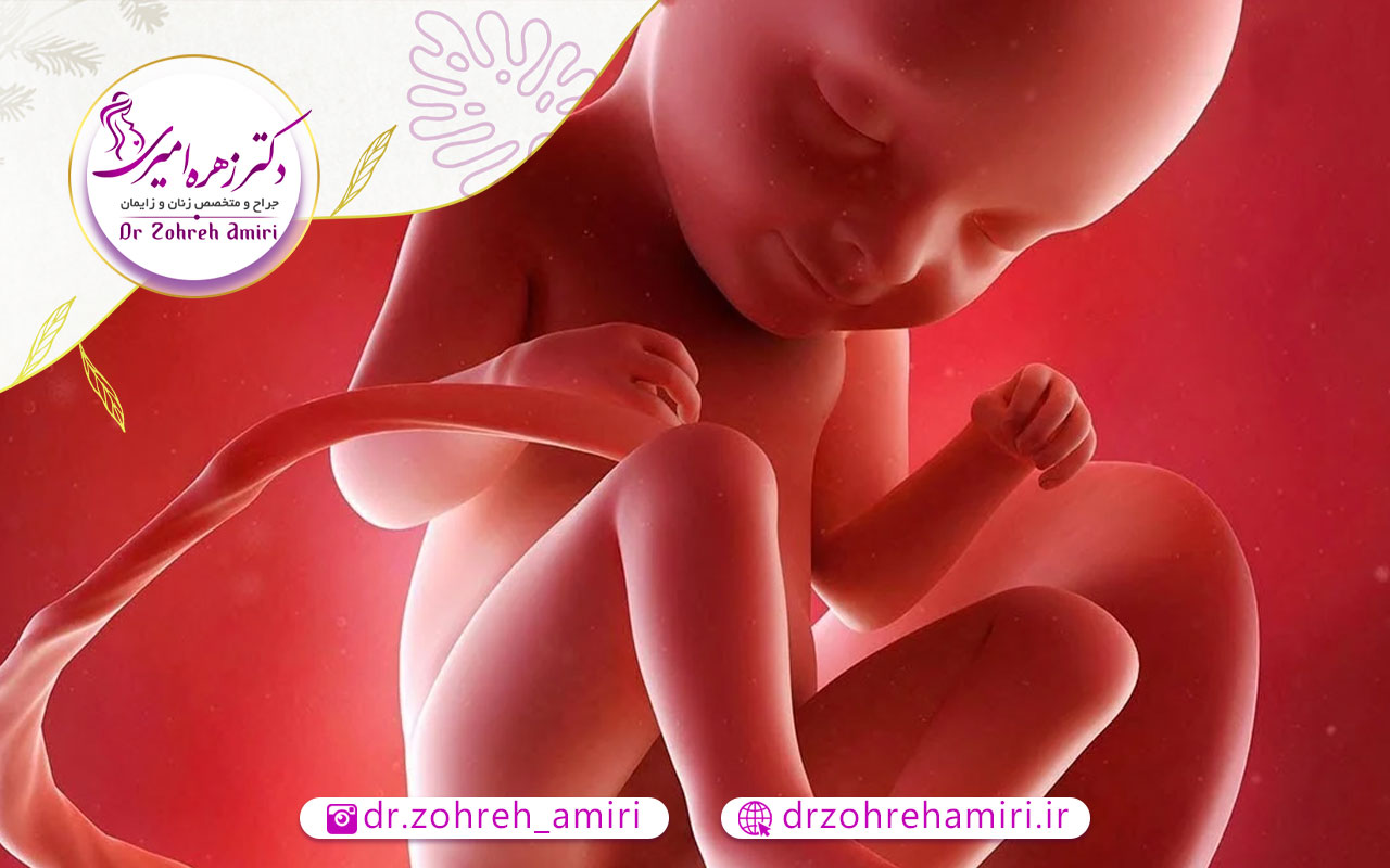 جفت پایین یا جفت سر راهی 1 جفت سر راهی چیست؟