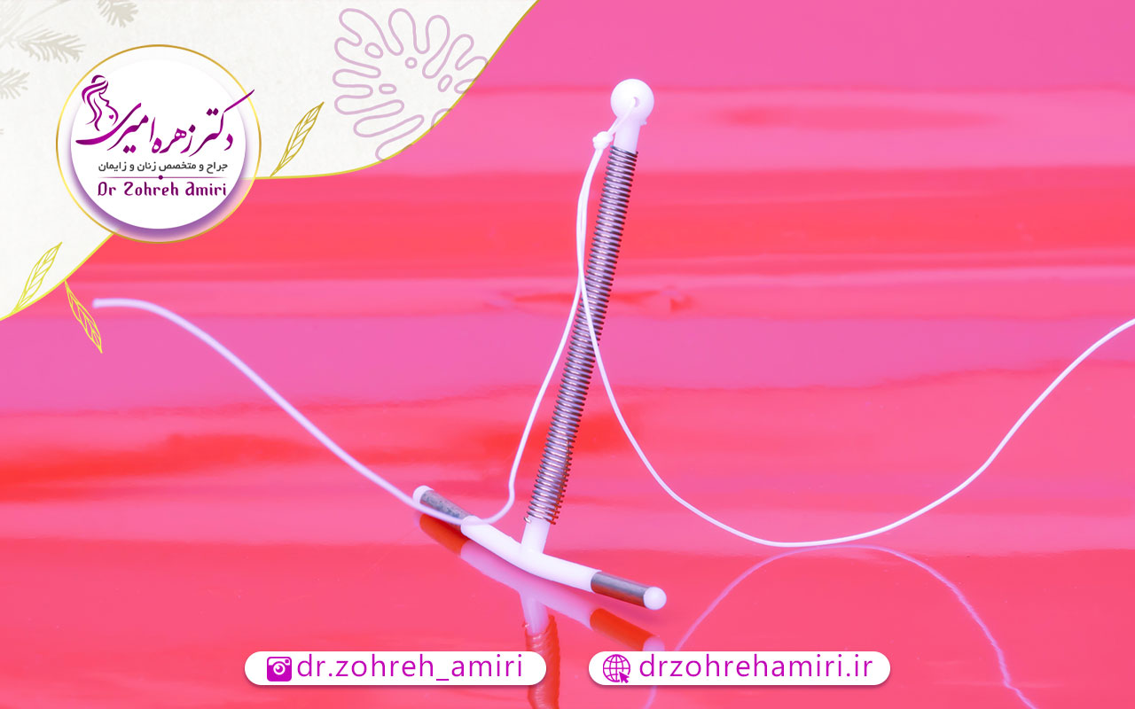 آی یو دی و قرار دادن آن در رحم 3 محدودیت استفاده از آی یو دی