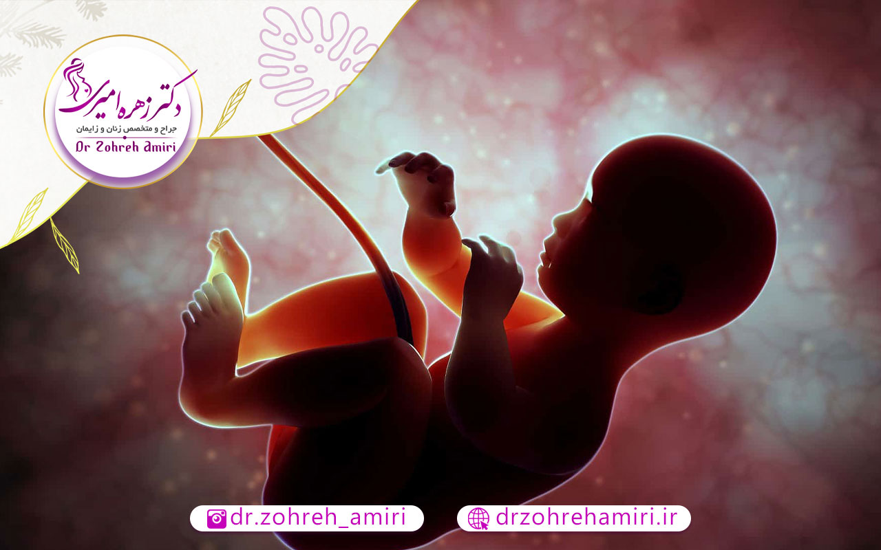 جفت پایین یا جفت سر راهی 5 آسیب های احتمالی جفت پایین برای مادر و جنین