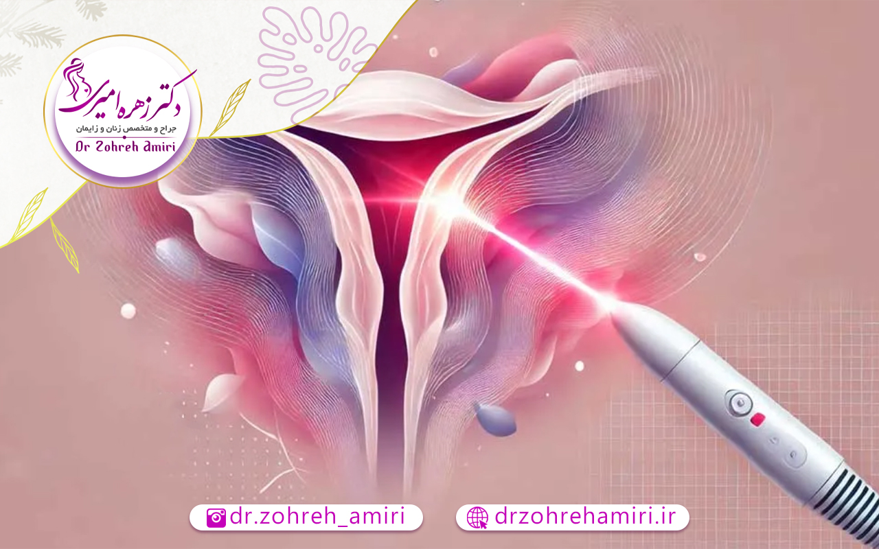 جوان سازی واژن 2 جوانسازی واژن با لیزر آنجلا