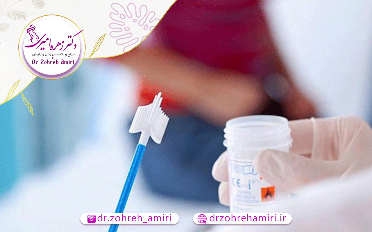 تست پاپ اسمیر 2