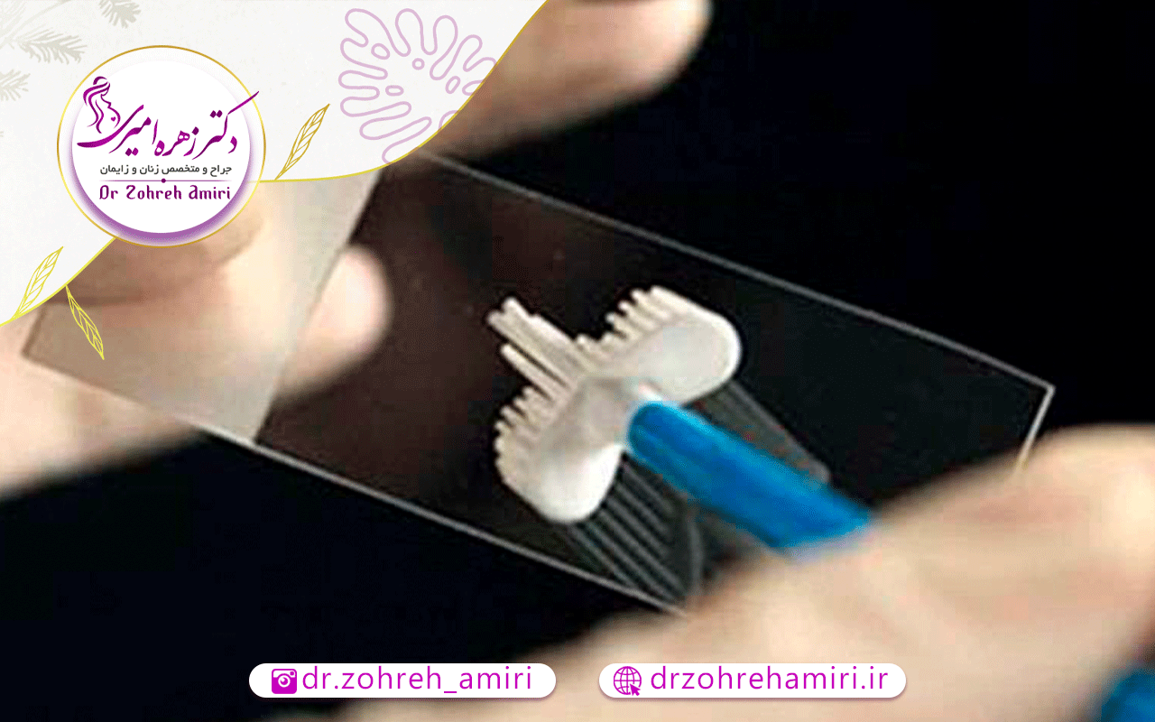 تست پاپ اسمیر 3 چند نکته مهم پیش از انجام تست پاپ اسمیر