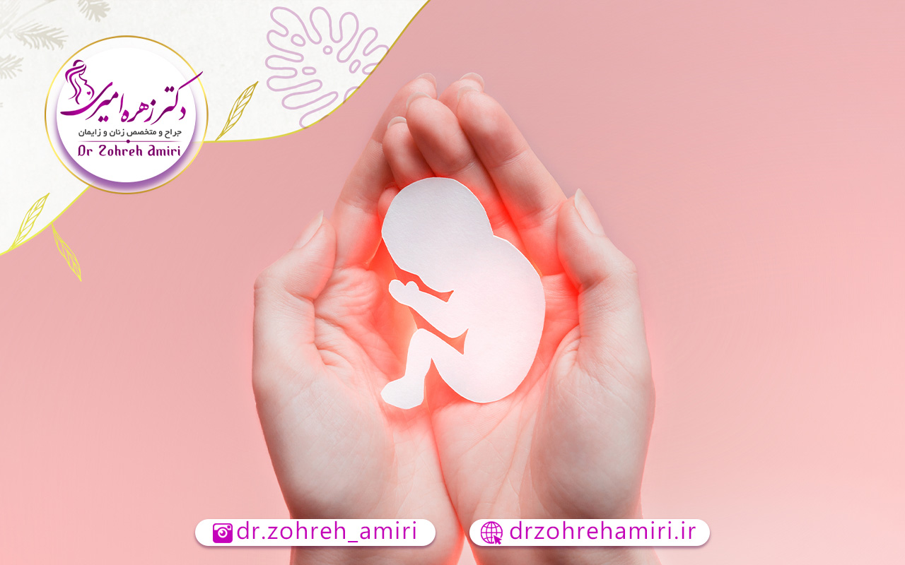 جفت پایین یا جفت سر راهی 6 علت پایین بودن جفت