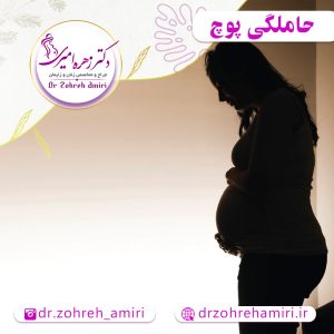 مقالات 2 حاملگی مولار یا پوچ
