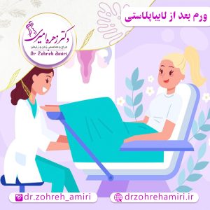 مقالات 6 درمان ورم بعد از عمل لابیاپلاستی