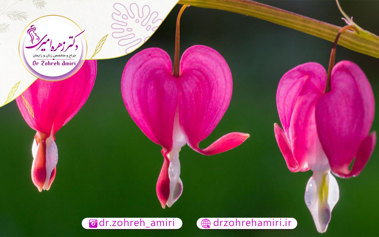 گوشت اضافه بعد از لابیاپلاستی 1 پیشگیری از ایجاد گوشت اضافه بعد از لابیاپلاستی