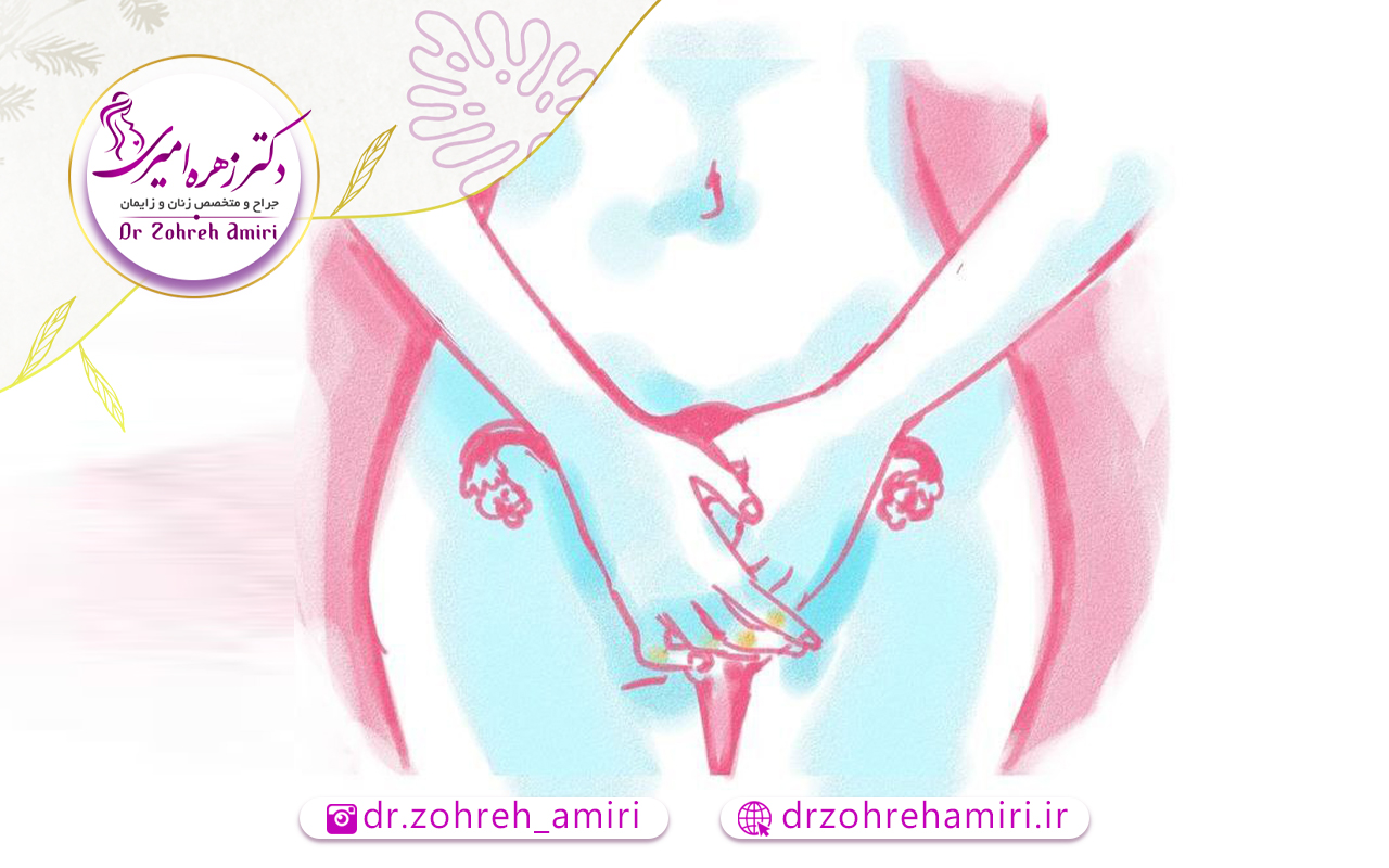 گوشت اضافه بعد از لابیاپلاستی 2 درمان گوشت اضافه بعد از لابیاپلاستی