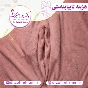 مقالات 9 هزینه لابیاپلاستی