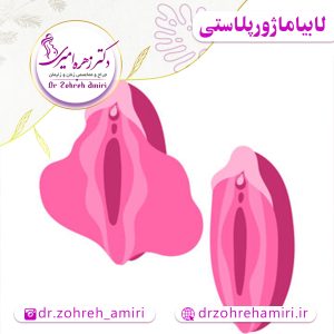 جراحی لابیاماژورپلاستی