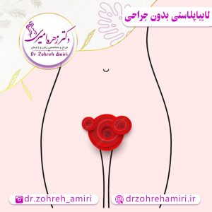 لابیاپلاستی بدون جراحی