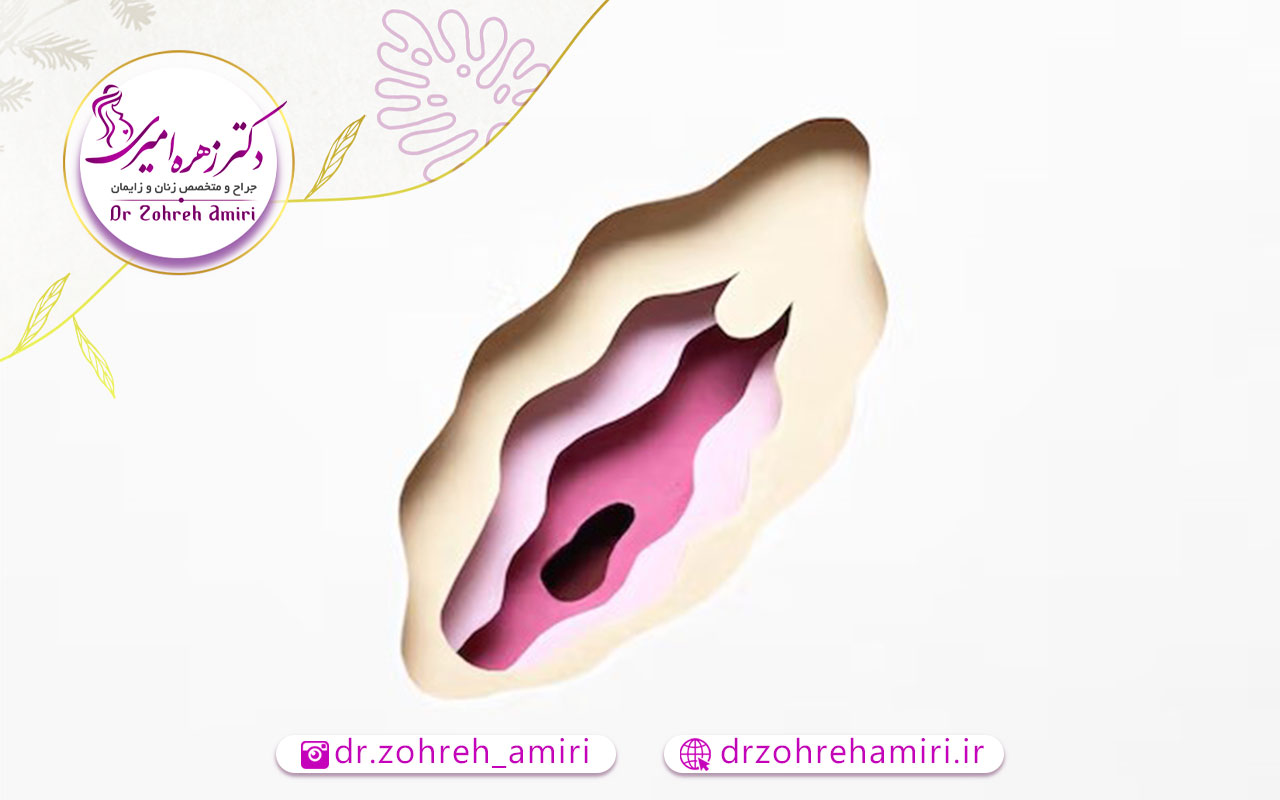 بهترین سن لابیاپلاستی 2 بررسی روند لابیاپلاستی در سنین مختلف