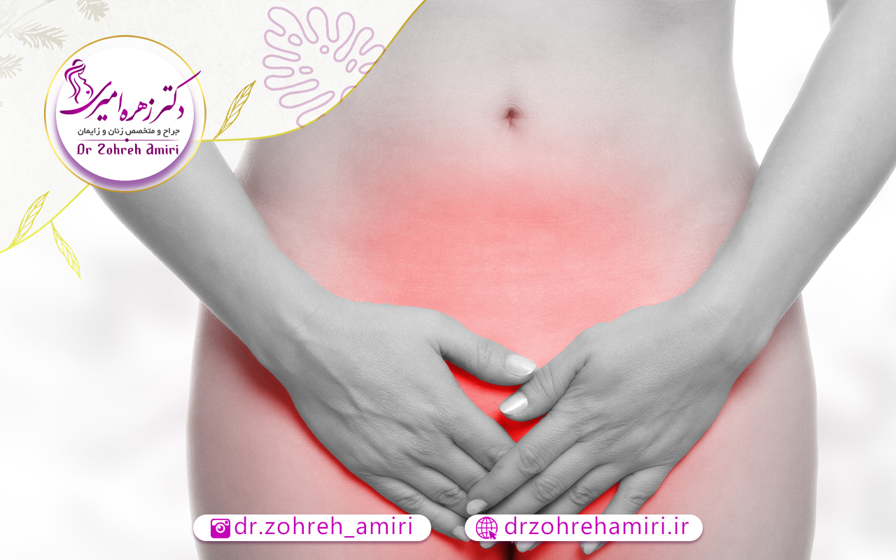 عفونت بعد از لابیاپلاستی 1 علائم بروز عفونت بعد از لابیاپلاستی