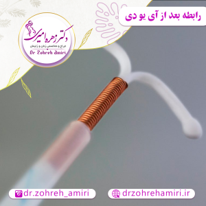 رابطه جنسی بعد از گذاشتن آی یو دی
