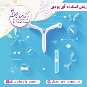بهترین زمان گذاشتن آی یو دی