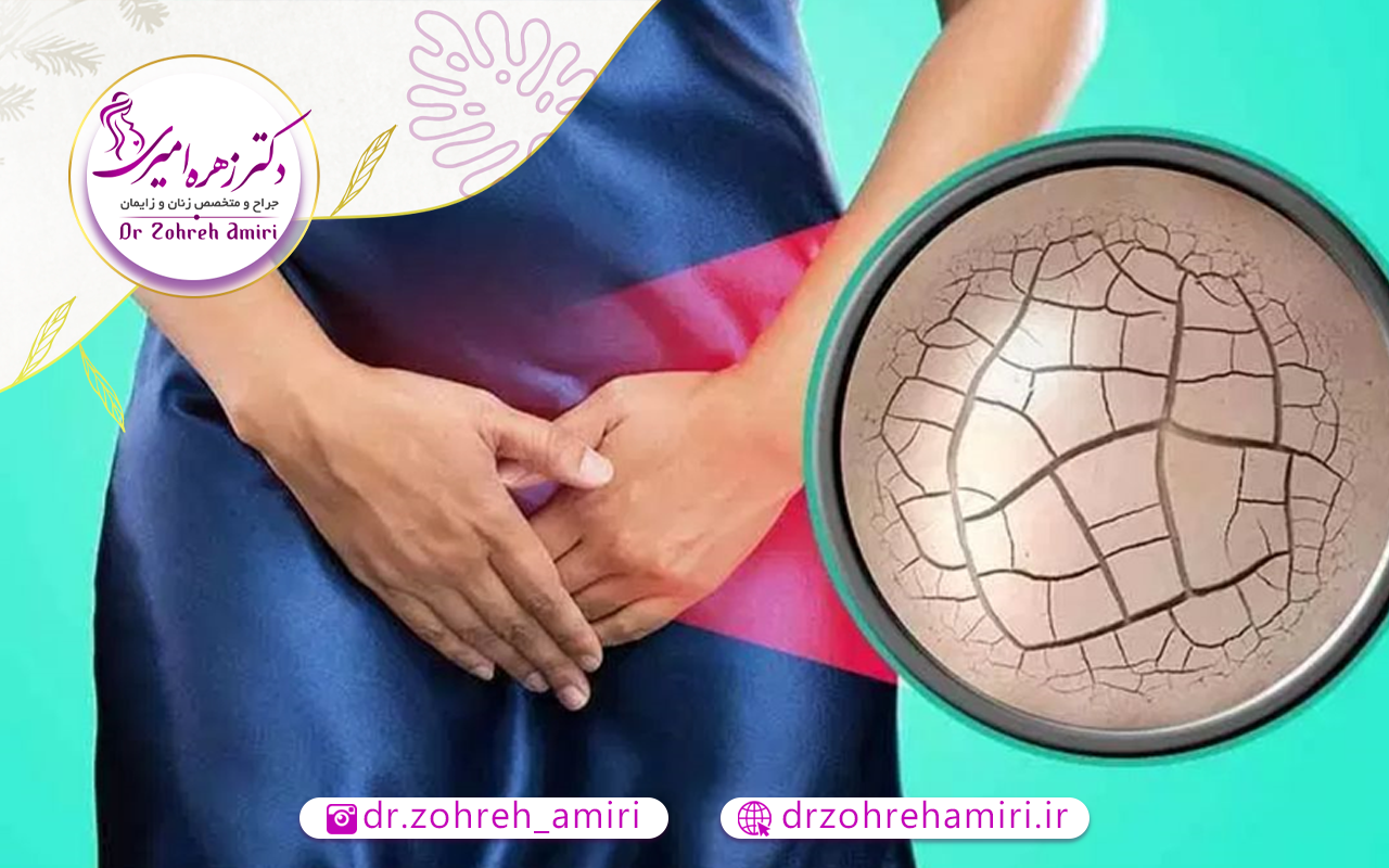 درمان خشکی واژن 1 خشکی واژن چگونه درمان می شود؟