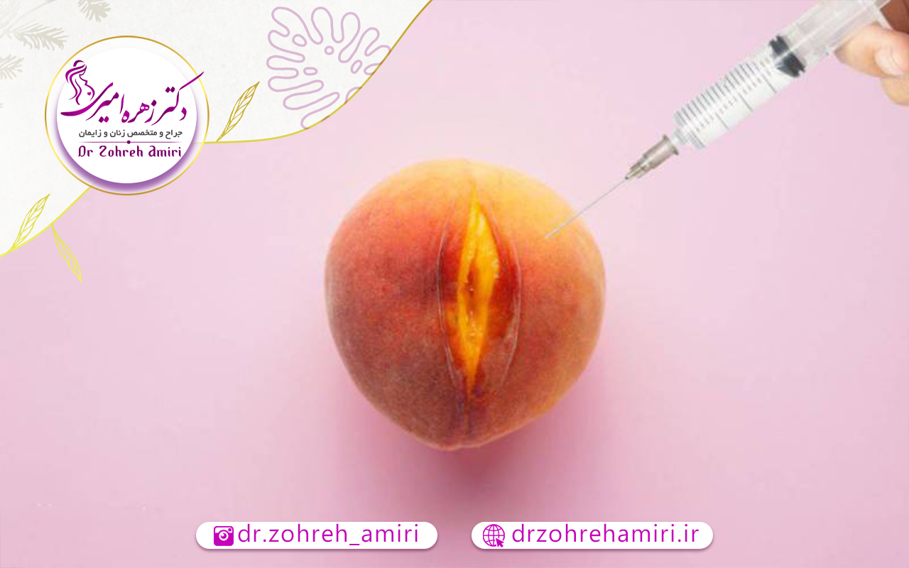 تزریق چربی به واژن 3 عوارض تزریق چربی به واژن