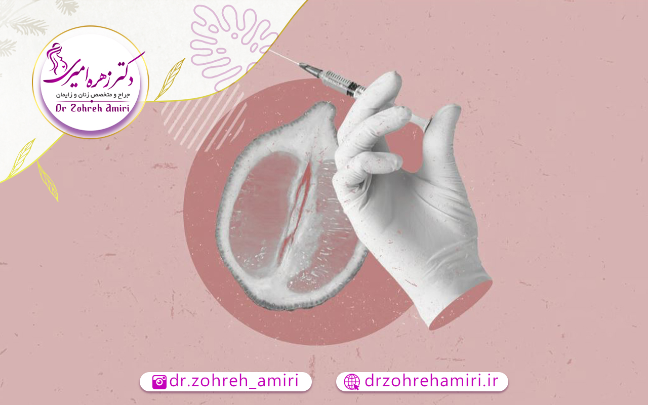 جوان سازی واژن 4 مزایا جوانسازی واژن