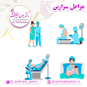 مقالات 8 مراحل زایمان سزارین