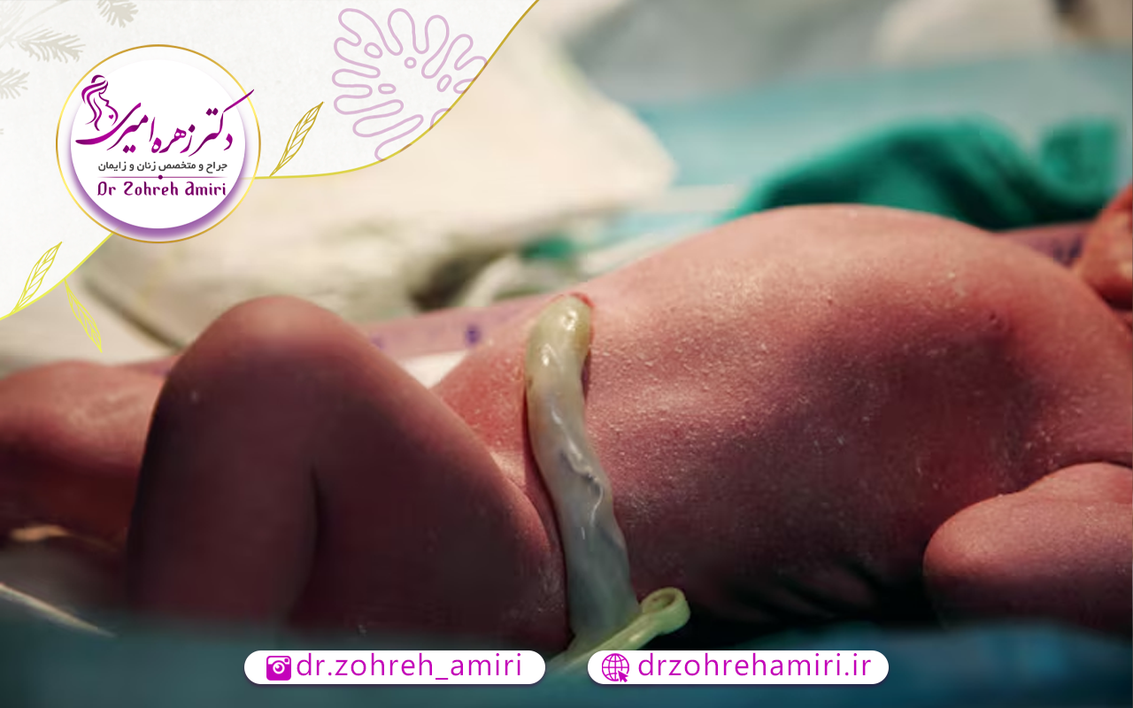 مراحل زایمان سزارین 1 آماده سازی برای زایمان سزارین